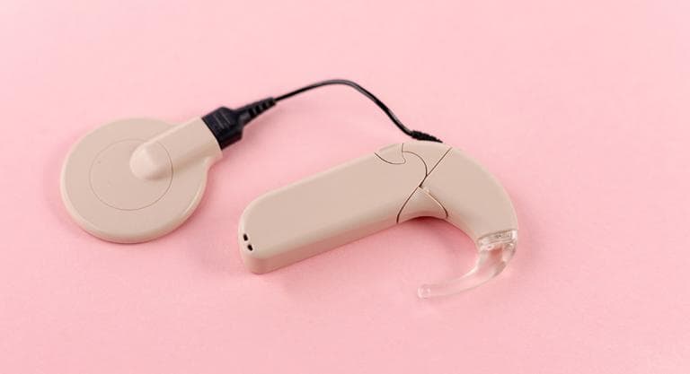 Actividades de estimulación